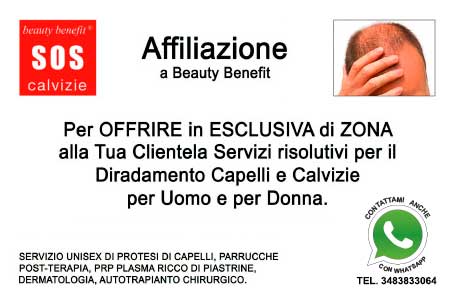Sos Calvizie coupon-sos